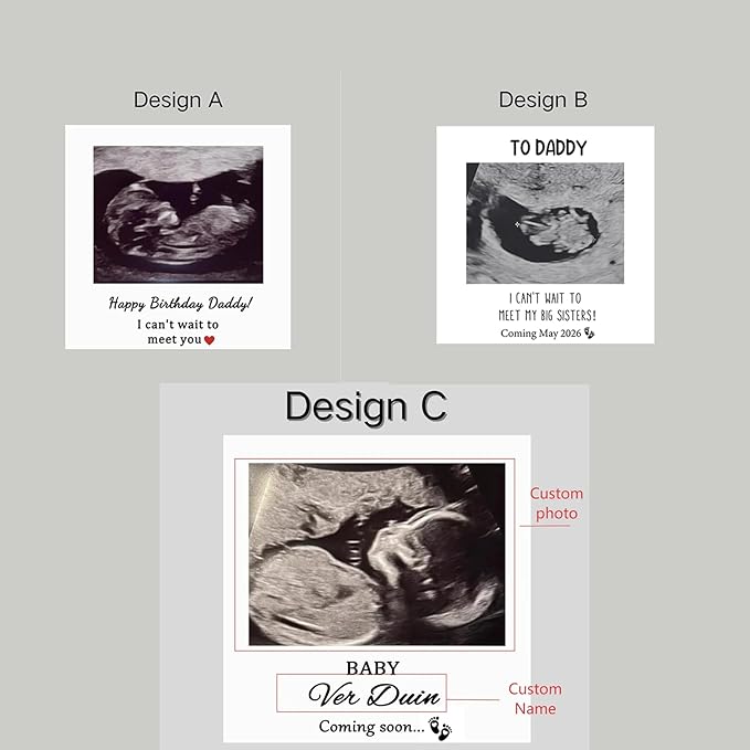 NAZENTI Personalised Ultrasound Building Blocks gifts for Husband, New Dad, Baby Scan Photo Building Block gifts for Christmas Fathers Day Valentine, Custom Puzzle Decor for Family