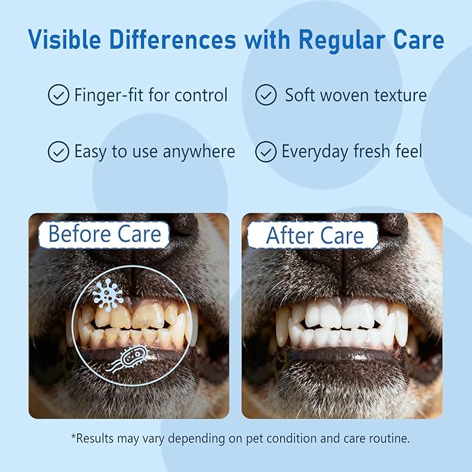 80 Counts Pet Dental Finger Wipes for Dogs and Cats - Disposable Dog Teeth Cleaning Wipes for No-Rinse Daily Oral Care, Pet Tooth Cleaning Wipes